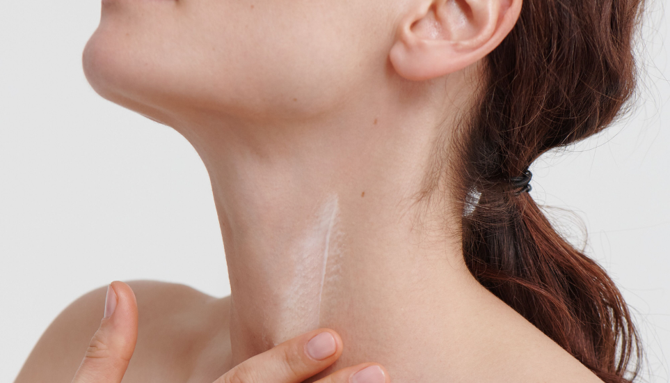 Why Your Neck and Décolleté Deserve Extra Care